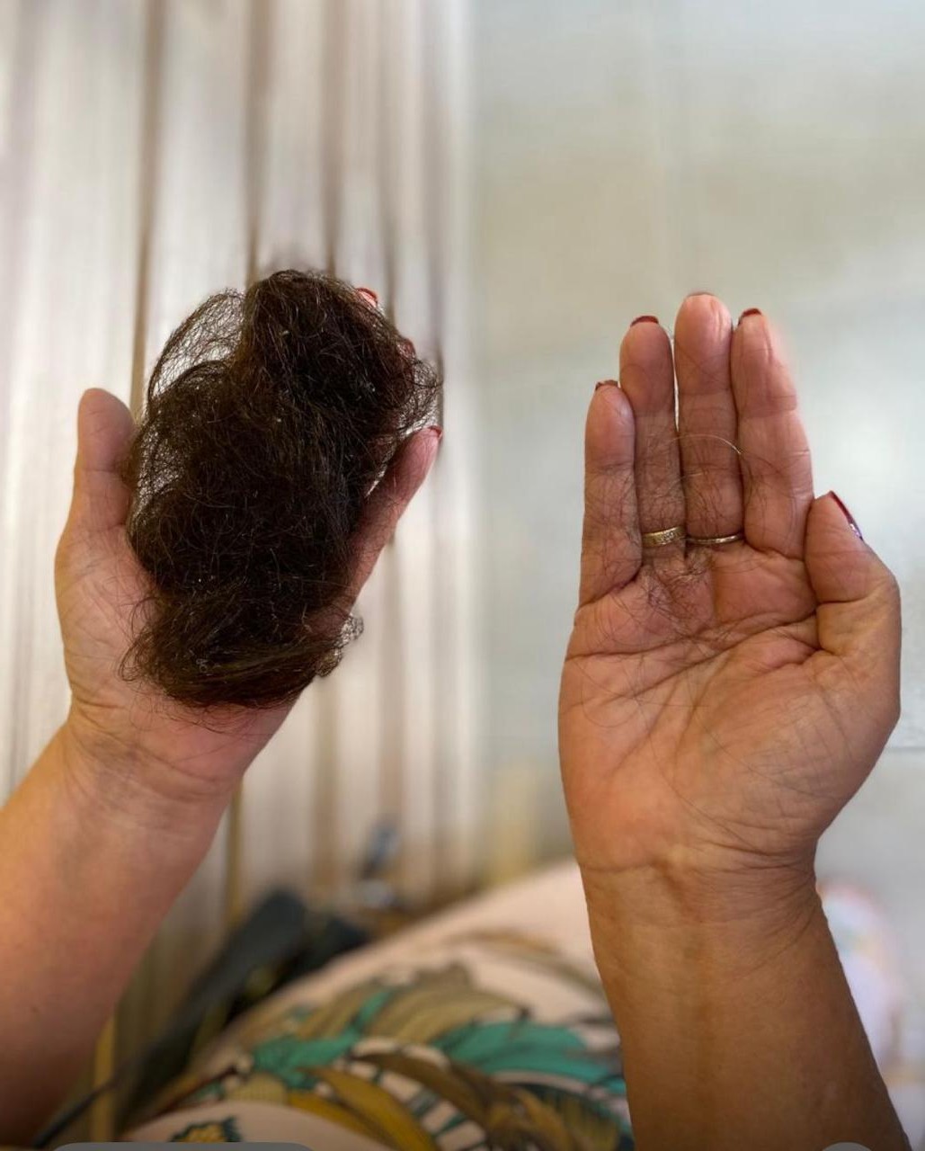 Antes e depois — cliente após 90 dias de uso do Protocolo Magia Grow